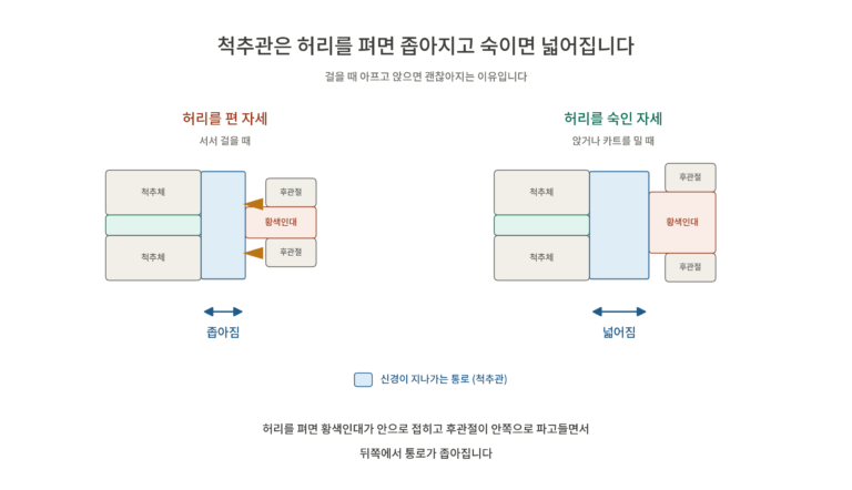 걸으면 다리가 아프고, 앉으면 괜찮아지는 이유