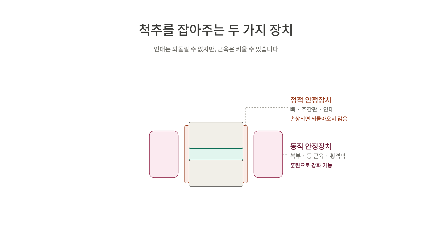 척추를 잡아주는 두 가지 장치에 대한 설명. 왼쪽에는 정적 안정장치, 오른쪽에는 동적 안정장이치가 표시되어 있음.